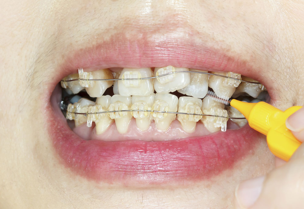 Ortodoncia dental